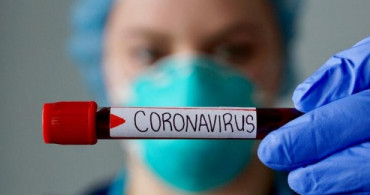 Uzmanlardan Coronavirüs Açıklaması: Başkasına Bulaşmasını Beklemiyoruz