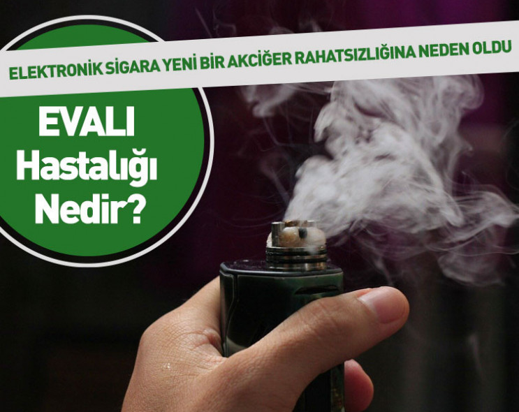 Elektronik sigara yeni akciğer hastalığına neden oldu adı: EVALI hastalığı nedir?