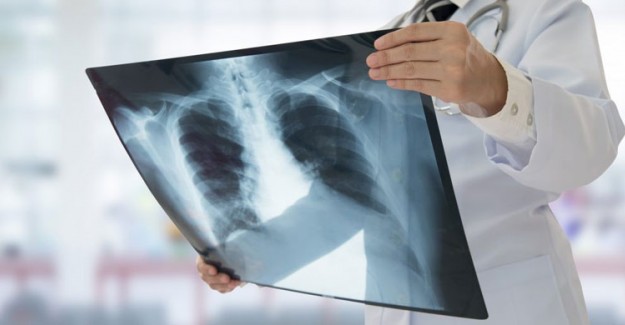 Akciğer Sağlığı İçin Hangi Besini Nasıl Tüketmeliyiz?