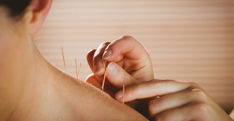 Akupunktur Ne İşe Yarar?