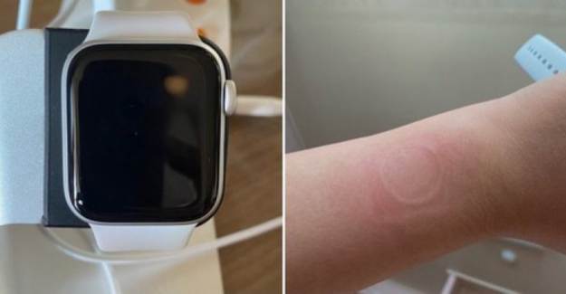 Apple Watch SE Cihazlarında Aşırı Isınma Sorunu