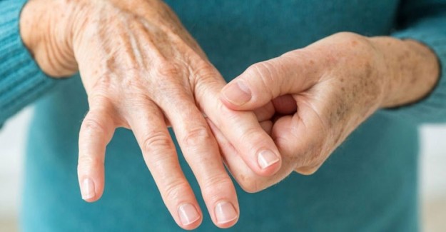 Artrit Nedir? Artrit Belirtileri Nelerdir ve Nasıl Tedavi Edilir?