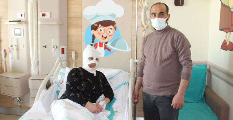 Başından Aşağı Çay Döküldü! Feci Şekilde Yandı!