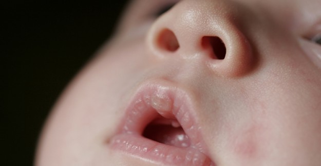 Bebeklerde Burun Tıkanıklığı Nasıl Geçer?