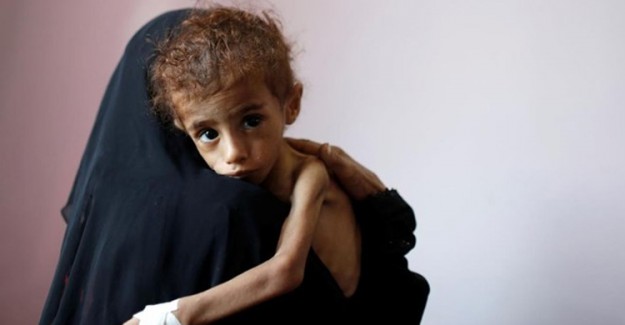 BM'den Yemen İçin Kıtlık Uyarısı