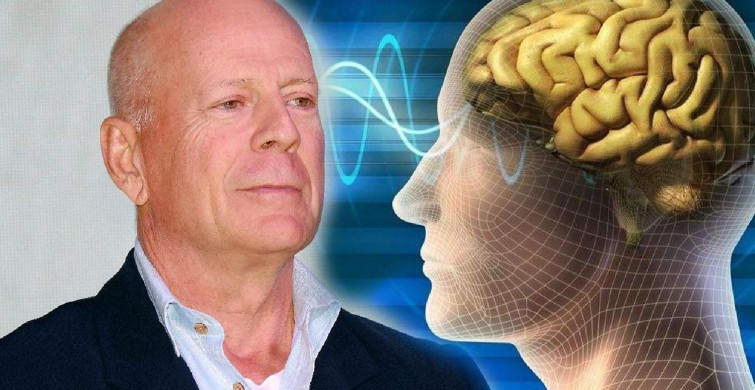 Bruce Willis'in hastalığı afazi nedir? Afazi hastalığı nedir, belirtileri nelerdir?