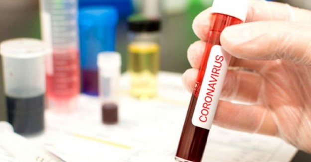 Coronavirüs İlacı Kevzara 7 Ülkede Denenmeye Başlandı