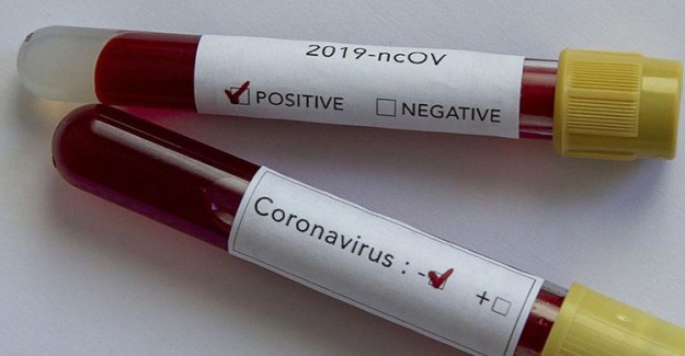 Coronavirüs Sindirim Yoluyla Bulaşıyor mu ?