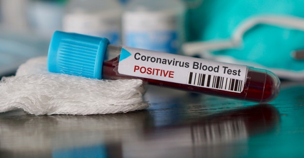 Danimarka'da  Coronavirüs Sebepli İlk Ölüm