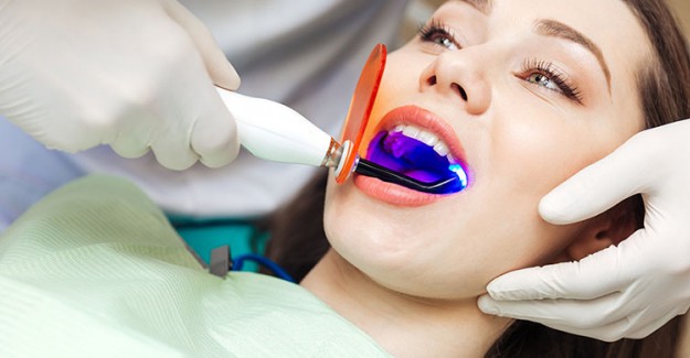 Diş Sararmalarını Önleyen Block Out Yöntemi Nedir?