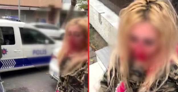 Eski Sevgilisinin Oğlu Tarafından Darp Edildi kadın: Kafa ve Yumruk Attı Sonra Yola Attı