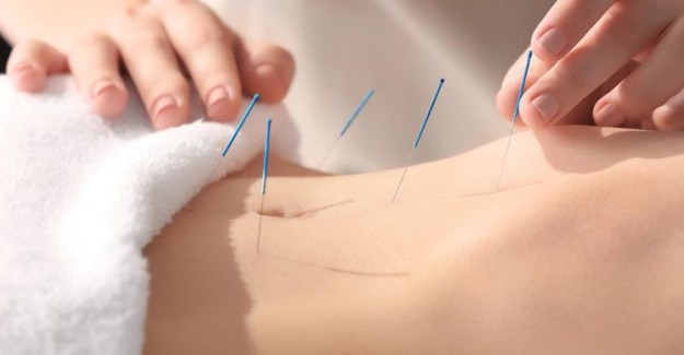 Gebe Kalmaya Yardımcı Oluyor! Akupunktur Hangi Hastalıklara İyi Gelir?