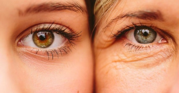 Göz Çevresi Kaç Yaşında Kırışmaya Başlar? Renkli Gözlüler Erken mi Kırışır?