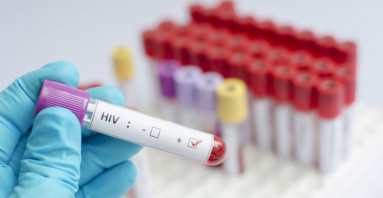 HIV nedir, belirtileri nelerdir, nasıl bulaşır, ölümcül müdür? HIV'in tespit edilen 3 bulaşma yolu