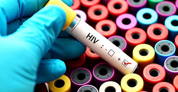 HIV Virüsü Nedir? HIV Virüsü Nasıl Bulaşır? 