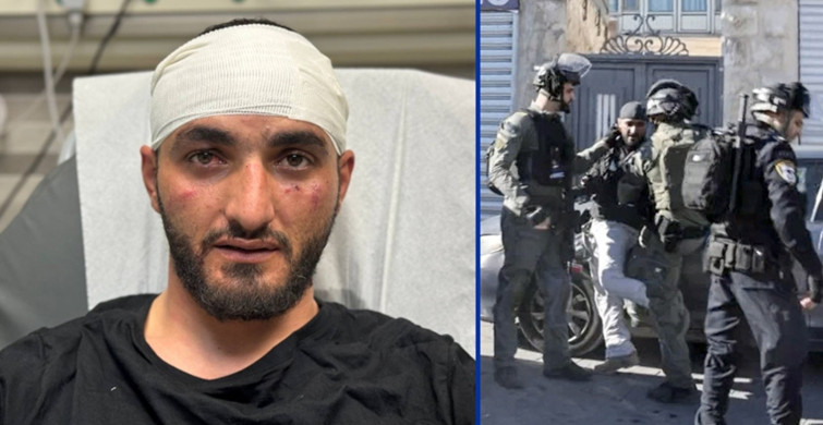 İşgalci İsrail polisleri Türk gazeteciye saldırdı: Tekmeleyerek darp ettiler