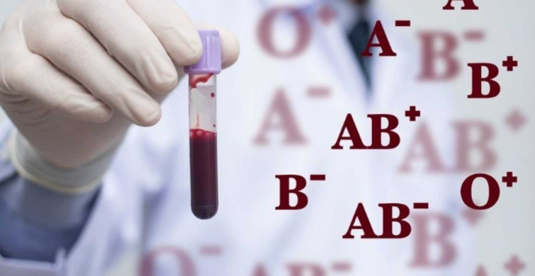 Kan grubu nereden, nasıl öğrenilir? Kan grubu öğrenmek için aç mı tok mu olmak gerekiyor? Kan grubu öğrenmek için test nerde yapılır?