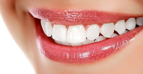 Karbonatla Diş Beyazlatma