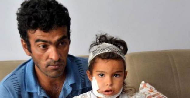 Kayseri'de Baba Kızını Kurdun Ağzından Kurtardı