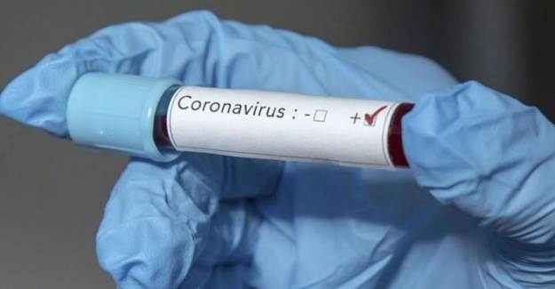Koronavirüs İlacından Kötü Haber Geldi