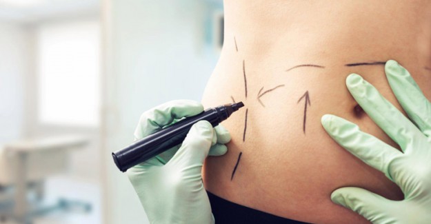 Liposuction Nedir? Avantajları Nelerdir?