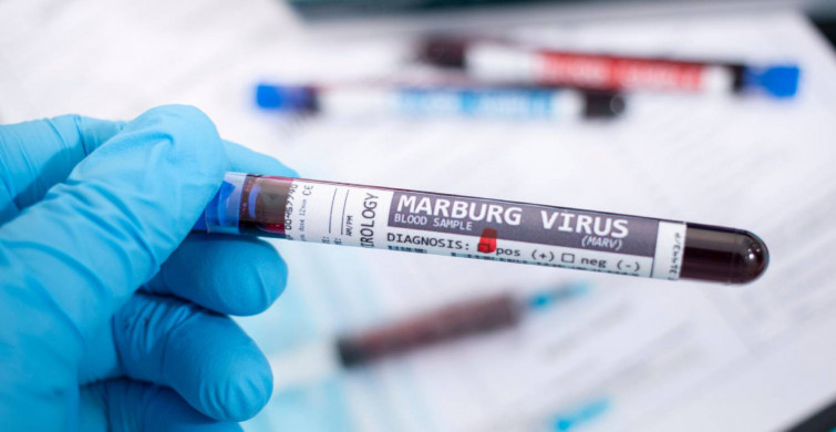 Marburg virüsü nedir, ölümcül mü? Marburg virüsü belirtileri neler, tedavisi var mı? Dünyanın en ölümcül virüsü yeniden ortaya çıktı