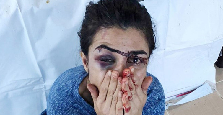 Melek İpek’in, 112 Personeliyle Konuşması Dava Dosyasında: Kocamı Vurdum, Yetişin