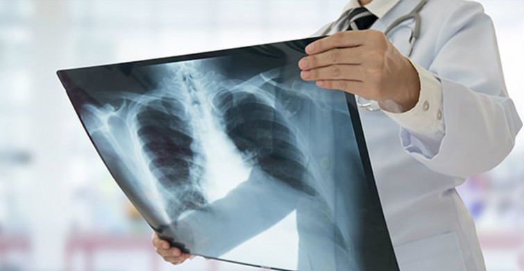 Rusya'da Skandal Olay! Röntgen Çektirmeye Giden Hastalar Hayatını Kaybetti