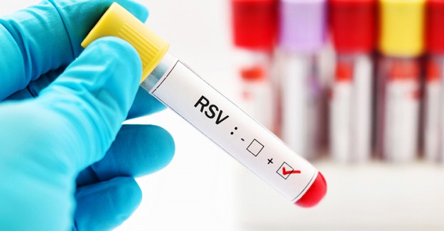 RSV Virüsüne Karşı Alınabilecek Önlemler