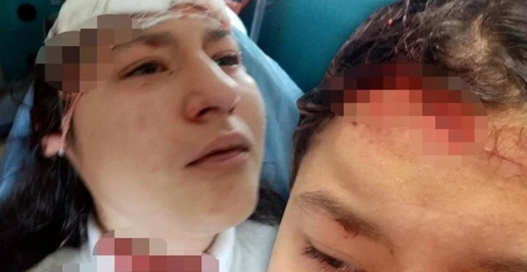Selfie Kurbanı: Kastamonu'da 14 Yaşındaki Kız Çocuğuna 5 Köpek Saldırdı!