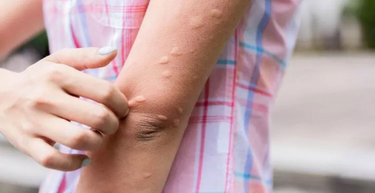 Sivrisinek ısırığından 11 kişi hayatını kaybetti: O bölge için alarm verildi