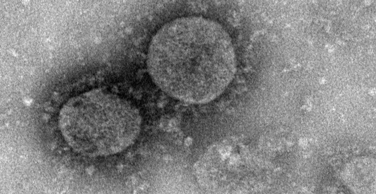 Son Dakika, Türkiye'de İlk Kez Havada Koronavirüs Tespit Edildi!