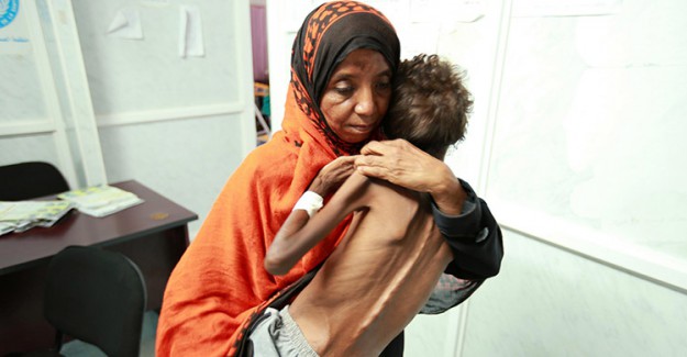 Yemen'de Açlık Sürüyor, 85 Bin Çocuk Hayatını Kaybetti