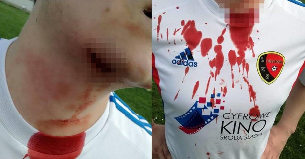 Yeşil Sahalarda Kan Döküldü! Taraftar Futbolcunun Boğazını Kesti! 