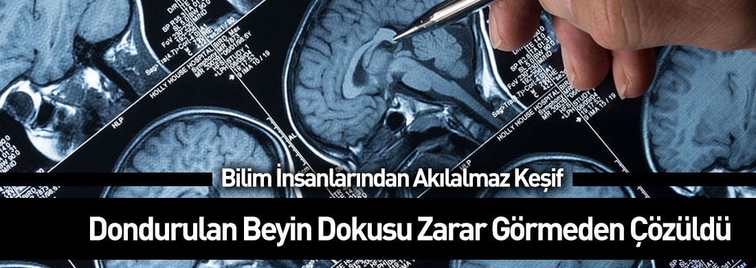 Bilim insanlarından akılalmaz keşif: Kriyojenik olarak dondurulan beyin dokusu zarar görmeden çözüldü