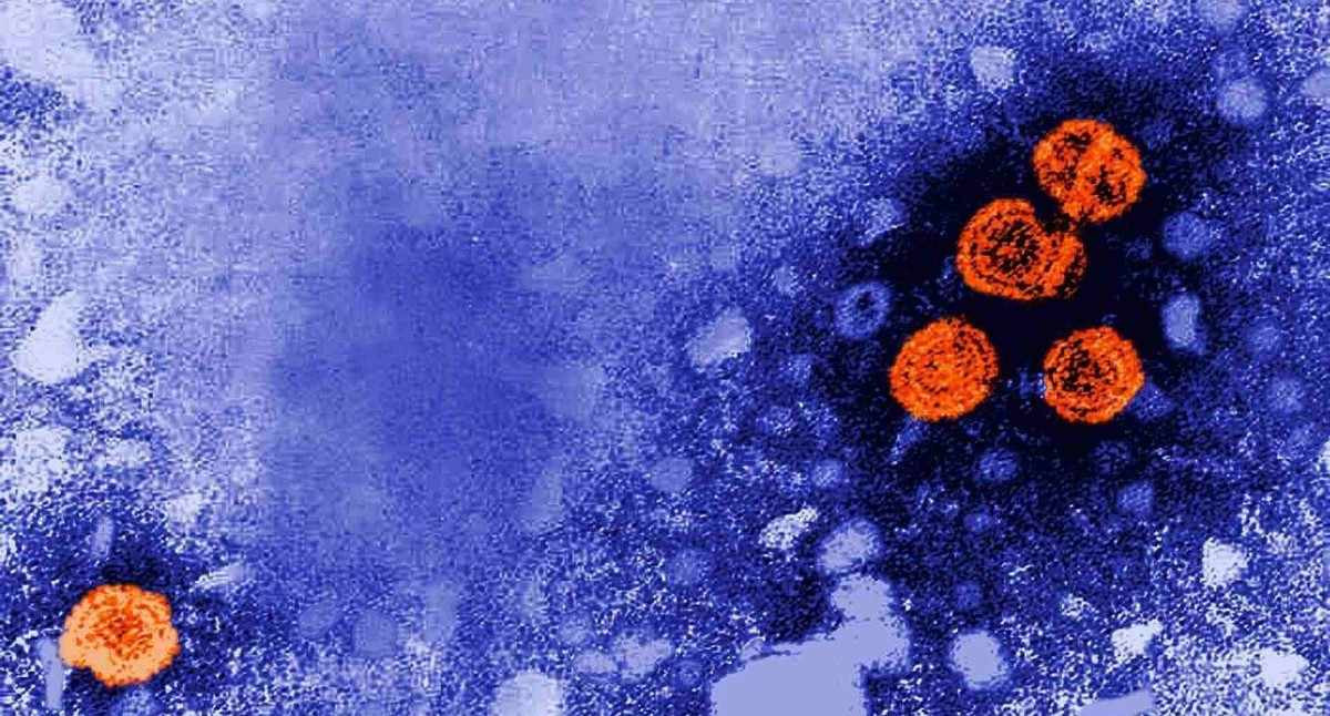 Gizemli hepatit salgını