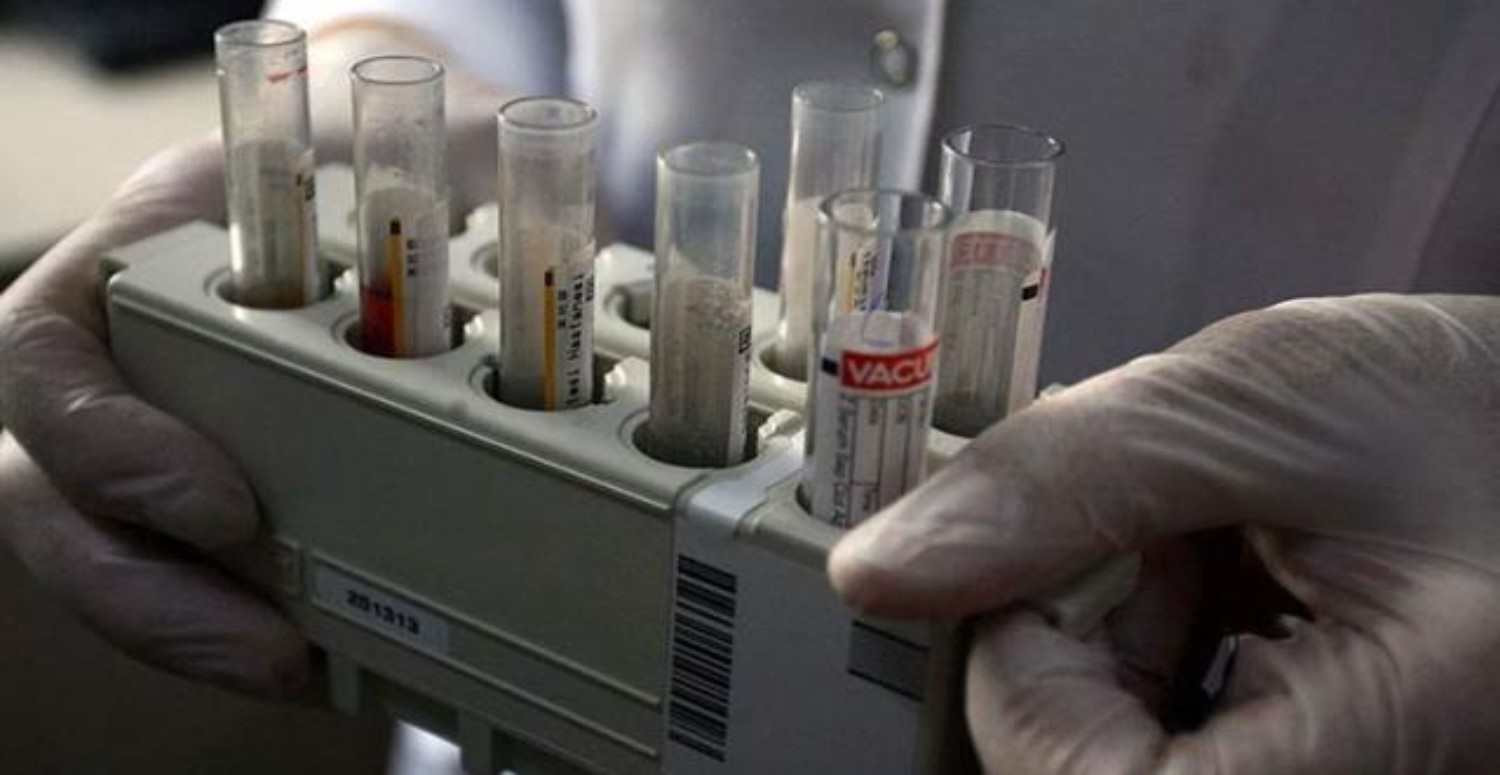 gizemli hepatit virüsü