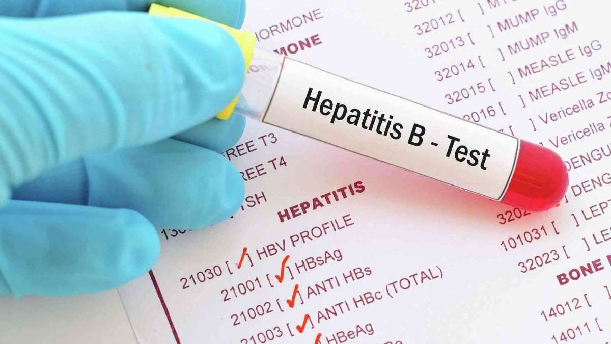 Gizemli hepatit virüsü belirtileri