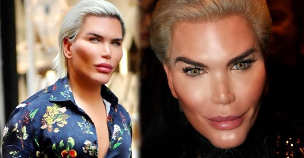 Oyuncak Ken E Benzemek Isteyen Rodrigo Alves Yeniden Ameliyat Masasina Yatti