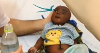 Türk Doktorlar Susuzluktan Ölmek Üzere Olan Afrikalı Bebeği Kurtardı